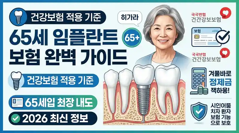 65세 임플란트 보험 적용 기준 총정리